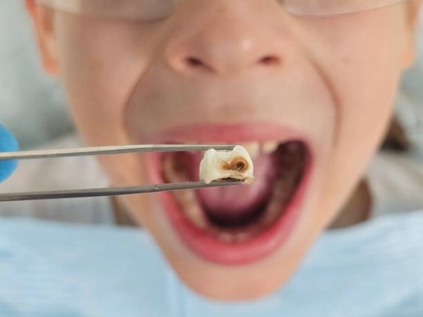 Best Pediatric Emergency Dentist in Hackberry, TX